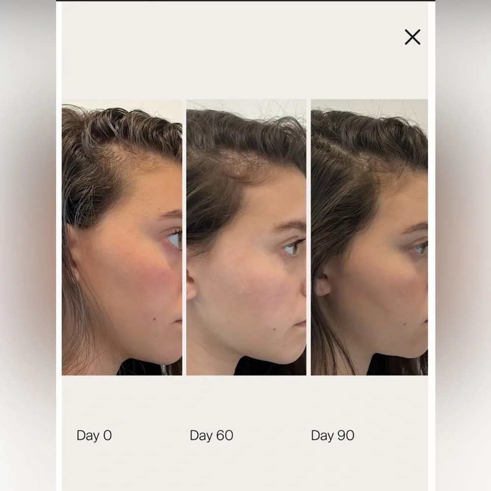 Living Proof Scalp Care Density Serum for Thinning & Greying Hair, 1.7 oz. MSRP - Picture 5 of 10